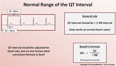 Corrected QT Interval (QTc)